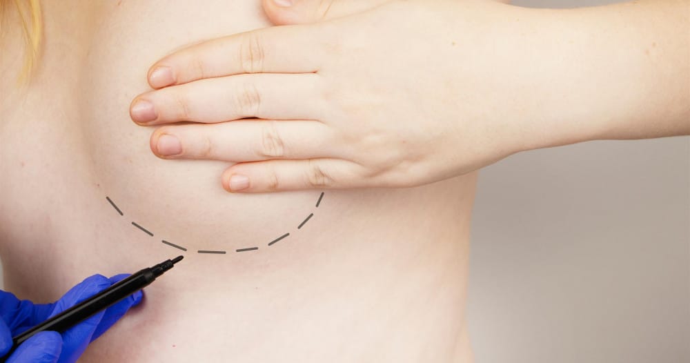 lipofilling des seins